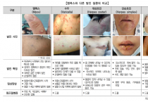 [오산시]  엠폭스‘주의’단계 격상.. 오산시, 감염병 감시체계 강화   -경기티비종합뉴스-